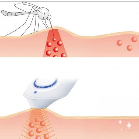Уред за третиране на ухапвания от комари Beurer BR10, Подходящ за бременни жени и деца, 300 приложения, Без химикали, Локално прилагане, Бял